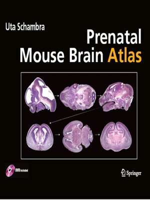 cover image of Prenatal Mouse Brain Atlas